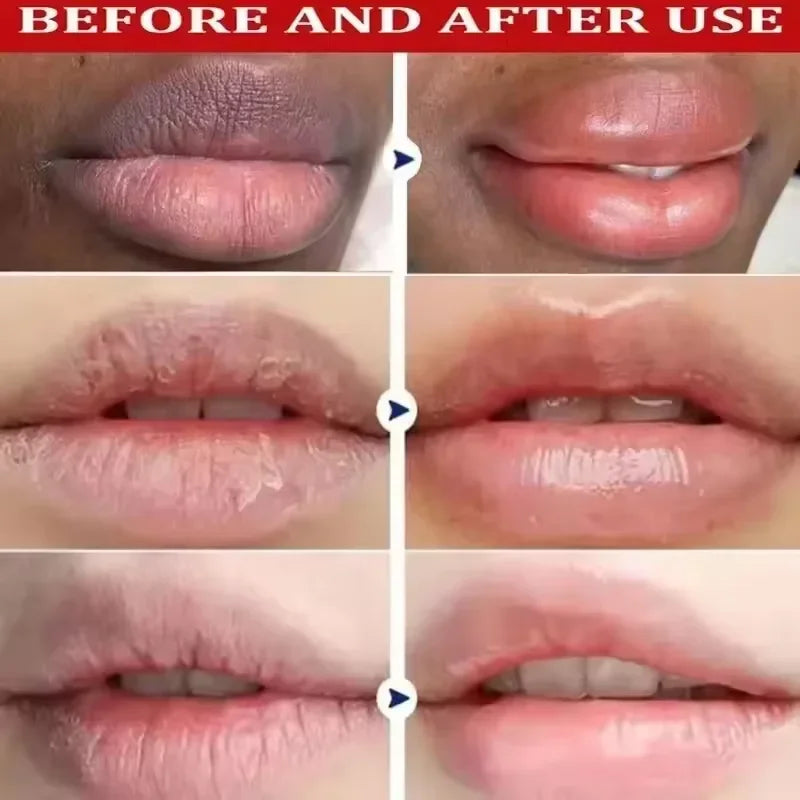 AliSolve™ Turmeric Lip Repair Mask | Advanced Hydrating Treatment