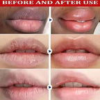AliSolve™ Turmeric Lip Repair Mask | Advanced Hydrating Treatment