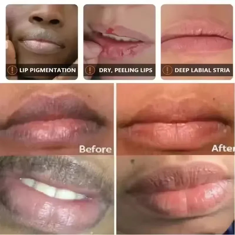 AliSolve™ Turmeric Lip Repair Mask | Advanced Hydrating Treatment
