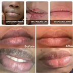 AliSolve™ Turmeric Lip Repair Mask | Advanced Hydrating Treatment
