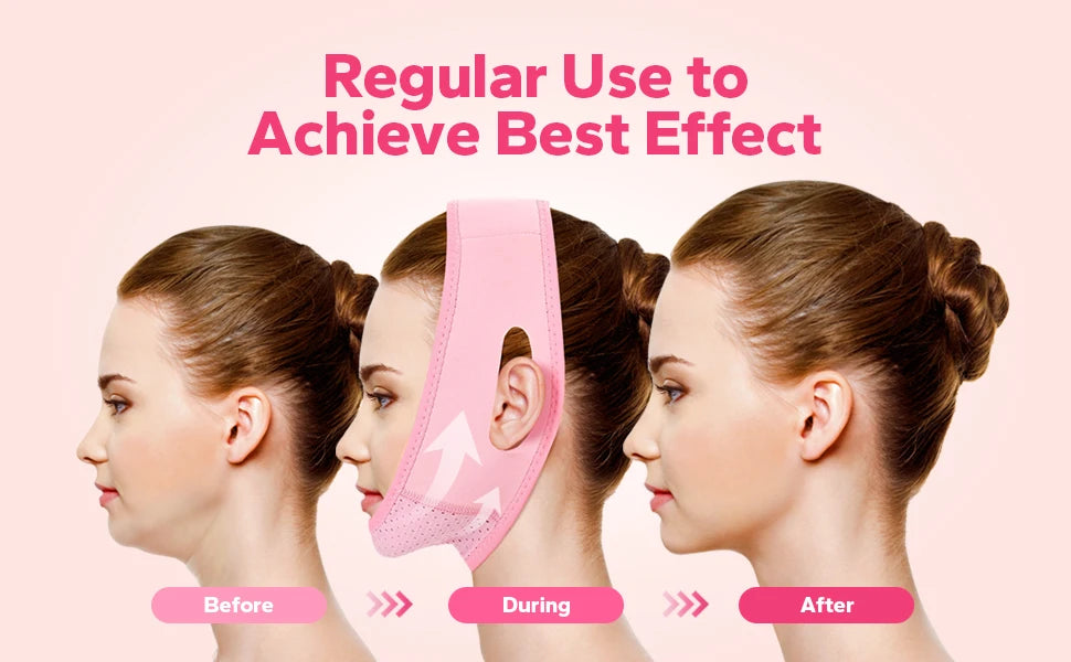 AliSolve™ V-Line Facial Shaping Strap | Premium Contour Lifting Mask